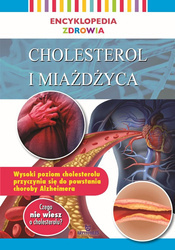 Cholesterol i miażdżyca. Encyklopedia zdrowia