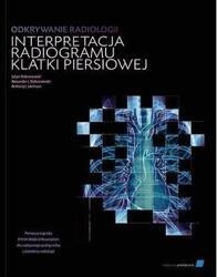 Odkrywanie radiologii: interpretacja radiogramu..