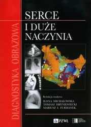 Diagnostyka obrazowa Serce i duże naczynia